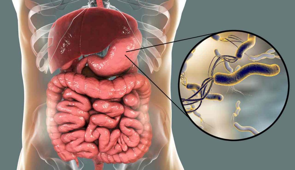 Helicobacter pylori